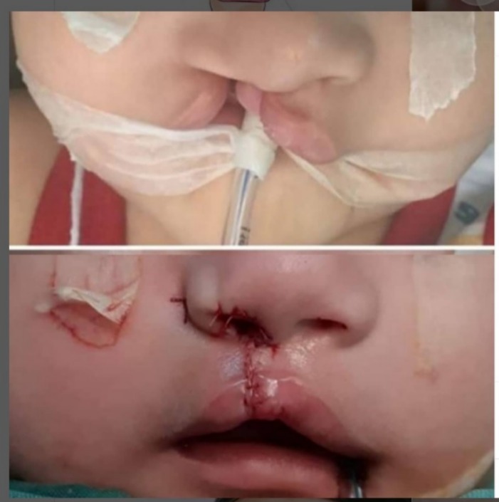 best platic surgeon in lahore