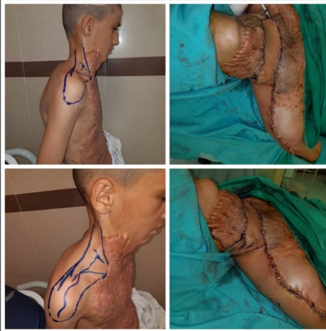 reconstructive surgery